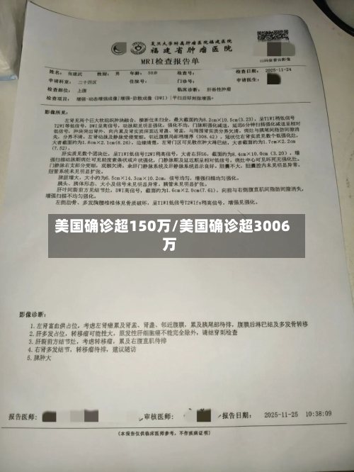 美国确诊超150万/美国确诊超3006万