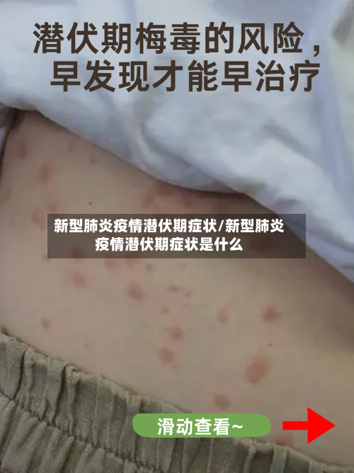 新型肺炎疫情潜伏期症状/新型肺炎疫情潜伏期症状是什么-第2张图片